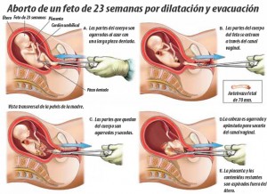 La realidad del aborto tardío